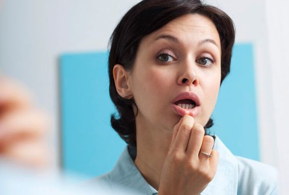 Mouth Ulcer: What Is It, Symptoms, Causes & Treatment